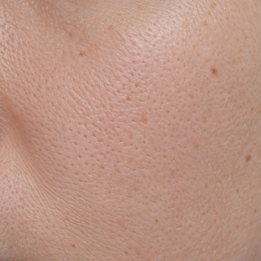 Illustrative close-up cheek skin, simulated after state with natural pores and skin detail retained
